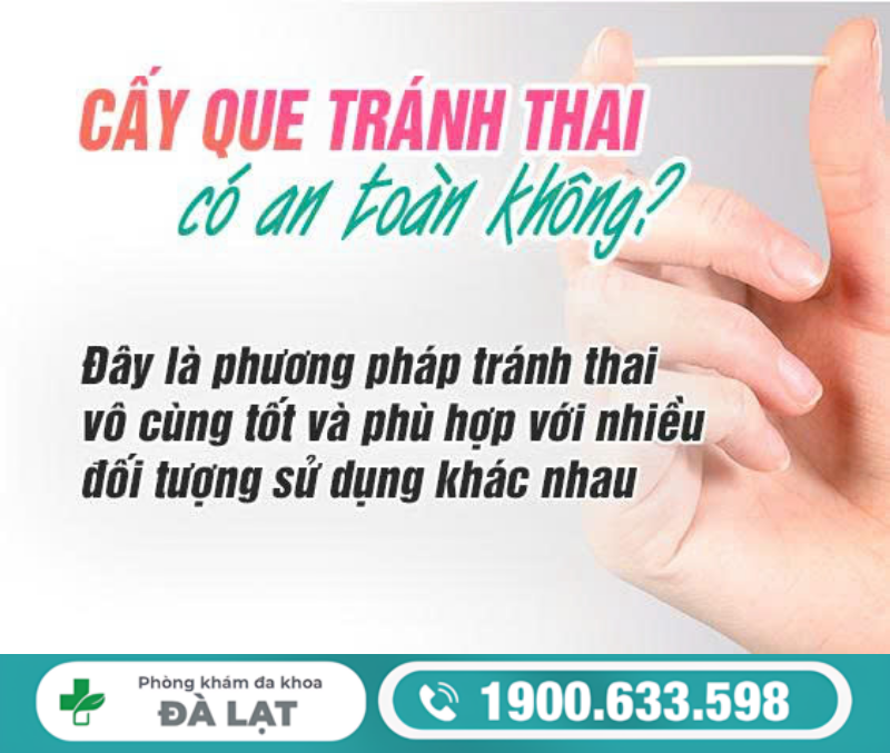 Hình ảnh minh họa